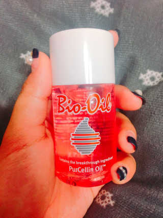 Bio-oil(바이오오일) 바이오오일(Bio-oil) — 4점을 준 리뷰어가 2017년 1월 올린 사용 사진