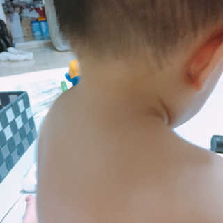 엘루스벤 에코스토어_네피밤 땀띠크림 — 5점을 준 리뷰어가 2017년 8월 올린 사용 사진