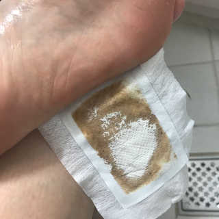 메디테라피 더마 릴렉스 힐링패치 — 4점을 준 리뷰어가 2018년 3월 올린 사용 사진