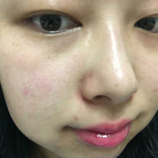 셀라피 에이리페어플러스크림 — 3.67점을 준 리뷰어가 2018년 4월 올린 사용 사진