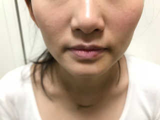 소똥이님이 올린 리뷰 사진 2