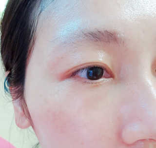 루이스 비드마 아이 콘투어 크림 30ml — 5점을 준 리뷰어가 2018년 7월 올린 사용 사진