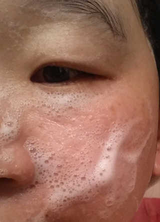 마마스케어 달맞이꽃 아기비누_민감하고 여린 피부 케어 — 5점을 준 리뷰어가 2018년 1월 올린 사용 사진