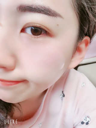 자이엘 S.O.S 레드 칙 케어팩 2 Box — 5점을 준 리뷰어가 2019년 10월 올린 사용 사진