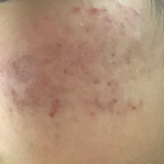 여름엔 이거 없으면 안돼 [버진팜스 푸딩수딩 크림] — 5점을 준 리뷰어가 2020년 1월 올린 사용 사진