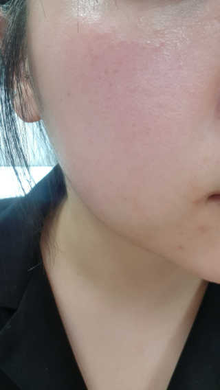 스킨그래머 슈퍼 굿 리페어 크림 — 3점을 준 리뷰어가 2019년 4월 올린 사용 사진