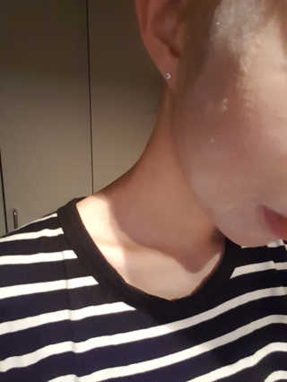셀퓨전씨 트리악 포어 딜리트 버블 팩 — 4.33점을 준 리뷰어가 2018년 4월 올린 사용 사진