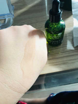 퓨어힐스 센텔라 90 앰플 + 센텔라 65 그린티팩 — 5점을 준 리뷰어가 2019년 3월 올린 사용 사진