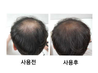 새콤달콤겸둥맘님이 올린 리뷰 사진 4