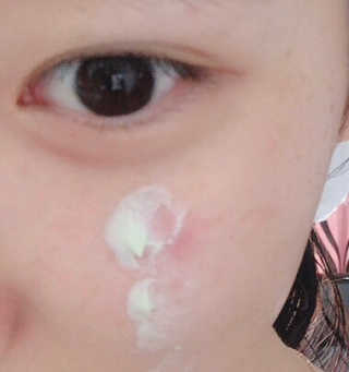 셀퓨전씨 카밍 다운 크림 — 5점을 준 리뷰어가 2018년 11월 올린 사용 사진