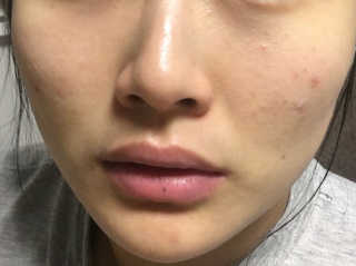 23years old 바데카실P — 4.5점을 준 리뷰어가 2016년 11월 올린 사용 사진