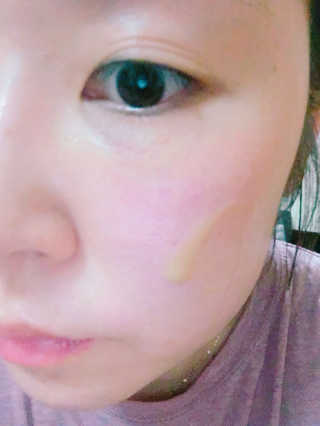 보타니티 [홍]조[진]정[결]케어 플라본 세럼 — 5점을 준 리뷰어가 2018년 5월 올린 사용 사진