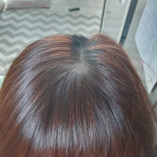 달리프 클로렐라 베러 루트 헤어토닉 100ml — 5점을 준 리뷰어가 2020년 1월 올린 사용 사진