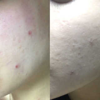 눈부신하늘님이 올린 리뷰 사진 3