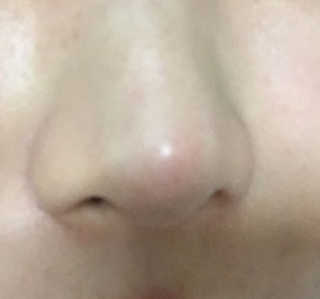 리르화장품 RIRE 올킬 블랙헤드 리무버 스틱 — 4.5점을 준 리뷰어가 2016년 12월 올린 사용 사진