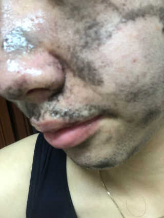 23years old 블랙페인트럽바 — 5점을 준 리뷰어가 2018년 7월 올린 사용 사진