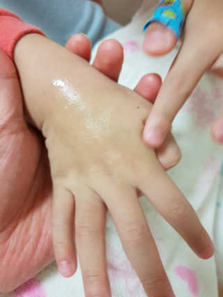 씨엘포 맥스 히아루로닉 프로폴리스 앰플 — 5점을 준 리뷰어가 2019년 1월 올린 사용 사진