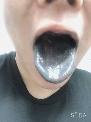 the naked object 디블랙팩치약 디블랙칫솔 세트 — 2점을 준 리뷰어가 2019년 2월 올린 사용 사진