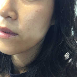 아이소이 코어탄력크림 — 5점을 준 리뷰어가 2018년 10월 올린 사용 사진