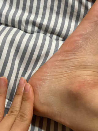 응가님이 올린 리뷰 사진 3