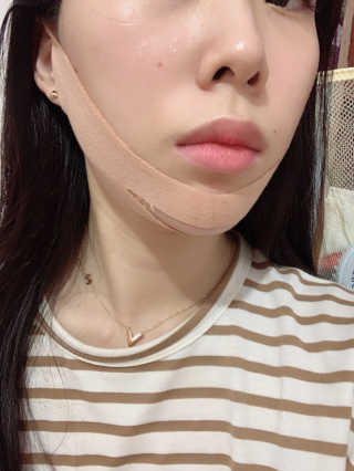 아이디플라코스메틱 아이디 페이스핏 마이너스 밴드 — 4점을 준 리뷰어가 2019년 11월 올린 사용 사진