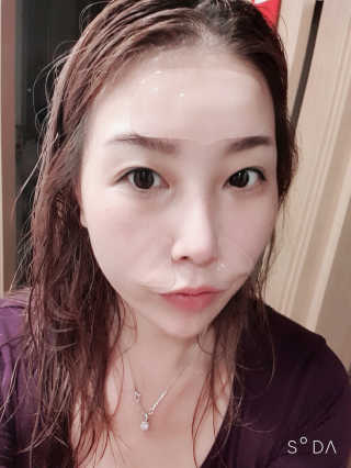 아이디플라코스메틱 아이디 페이스핏 플러스 패치 — 4점을 준 리뷰어가 2019년 10월 올린 사용 사진