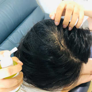 달리프 클로렐라 베러 루트 헤어토닉 100ml — 5점을 준 리뷰어가 2019년 8월 올린 사용 사진