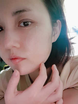 자이엘 S.O.S 레드 칙 케어팩 2 Box — 4점을 준 리뷰어가 2019년 11월 올린 사용 사진