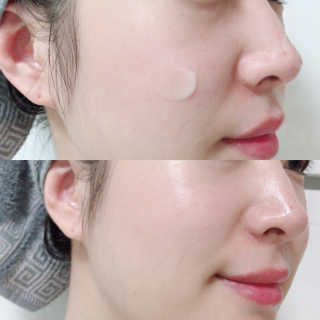 아이소이 불가리안 로즈 인텐시브 리프팅 세럼 20ml 탄력세럼 — 5점을 준 리뷰어가 2018년 11월 올린 사용 사진