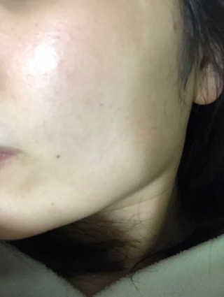 아이소이 파란소화기 응급스팟 — 5점을 준 리뷰어가 2018년 3월 올린 사용 사진