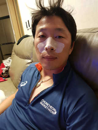 나이팅게일 TAKO PACK NOSE [문어코팩] — 5점을 준 리뷰어가 2018년 7월 올린 사용 사진