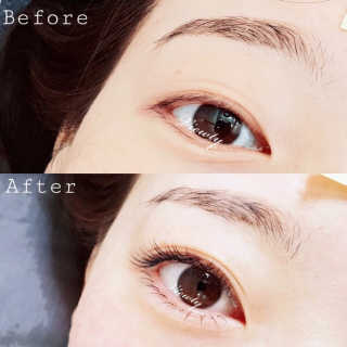 Viewty Skin and Lash [ViewtySkin＆Lash] 종아리 림프순환 부종관리 — 4.5점을 준 리뷰어가 2019년 2월 올린 사용 사진