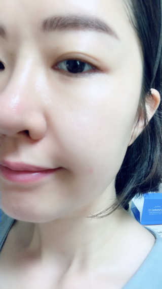 지고트 비타솔루션12 모이스처 앰플 크림 100ml — 3.5점을 준 리뷰어가 2019년 6월 올린 사용 사진