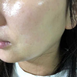 오르힐 울트라레이어 크림 — 5점을 준 리뷰어가 2020년 2월 올린 사용 사진