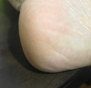 (주)에네스티 에네스티 수안수 실크스킨 풋크림 1+1 — 5점을 준 리뷰어가 2019년 11월 올린 사용 사진