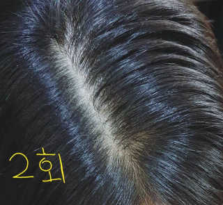 바로티나 [리뷰 상품권 이벤트] 즉시 굵어지는 헤어볼륨S — 5점을 준 리뷰어가 2019년 10월 올린 사용 사진