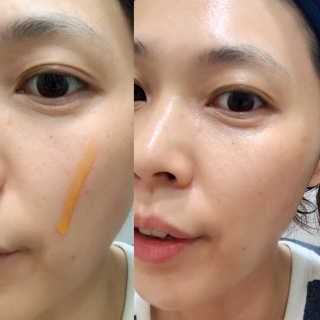 메디페르 루테인 포스앰플 50ml — 5점을 준 리뷰어가 2019년 10월 올린 사용 사진