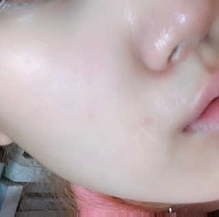 AHC 에이 에이치 씨 미니멀 10 워터리 에센스 — 5점을 준 리뷰어가 2018년 12월 올린 사용 사진