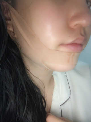 아이디플라코스메틱 아이디 페이스핏 마이너스 밴드 — 5점을 준 리뷰어가 2019년 10월 올린 사용 사진