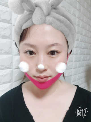 스케덤 펩타이드 리프팅밴드 — 5점을 준 리뷰어가 2019년 3월 올린 사용 사진