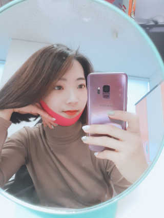 스케덤 펩타이드 리프팅밴드 — 5점을 준 리뷰어가 2019년 2월 올린 사용 사진