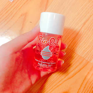 Bio-oil(바이오오일) 바이오오일 — 5점을 준 리뷰어가 2016년 10월 올린 사용 사진