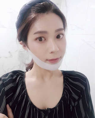 스케덤 클루덤 리프팅 패치 — 4점을 준 리뷰어가 2019년 3월 올린 사용 사진