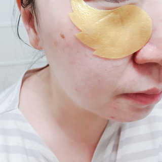 푸츄푸츄 Real repair skin cell premium patch — 3점을 준 리뷰어가 2018년 10월 올린 사용 사진