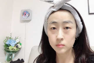 웰더마 차 이슬 티트리 수딩 앰플 마스크 — 4점을 준 리뷰어가 2019년 5월 올린 사용 사진