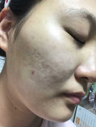 최보배님이 올린 리뷰 사진 4