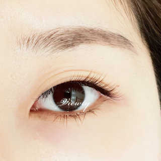 Viewty Skin and Lash [ViewtySkin＆Lash] 종아리 림프순환 부종관리 — 5점을 준 리뷰어가 2019년 4월 올린 사용 사진