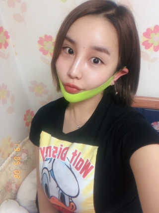 스케덤 시카 리프팅밴드 — 5점을 준 리뷰어가 2019년 5월 올린 사용 사진