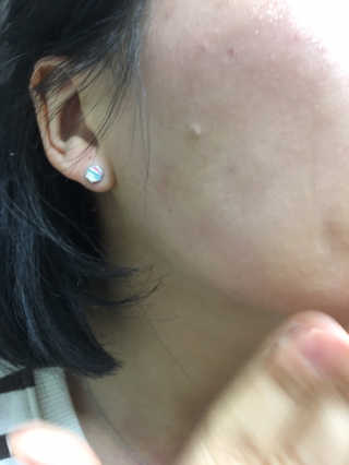 아미니 릴렉싱 페이셜 클렌징 오일 — 4점을 준 리뷰어가 2019년 1월 올린 사용 사진