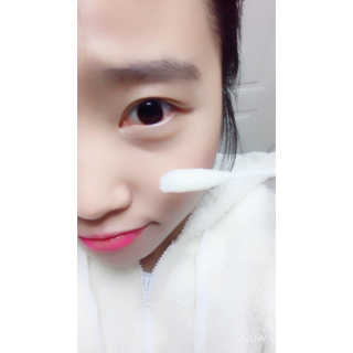 나이팅게일 토닝이레이저 — 5점을 준 리뷰어가 2016년 12월 올린 사용 사진